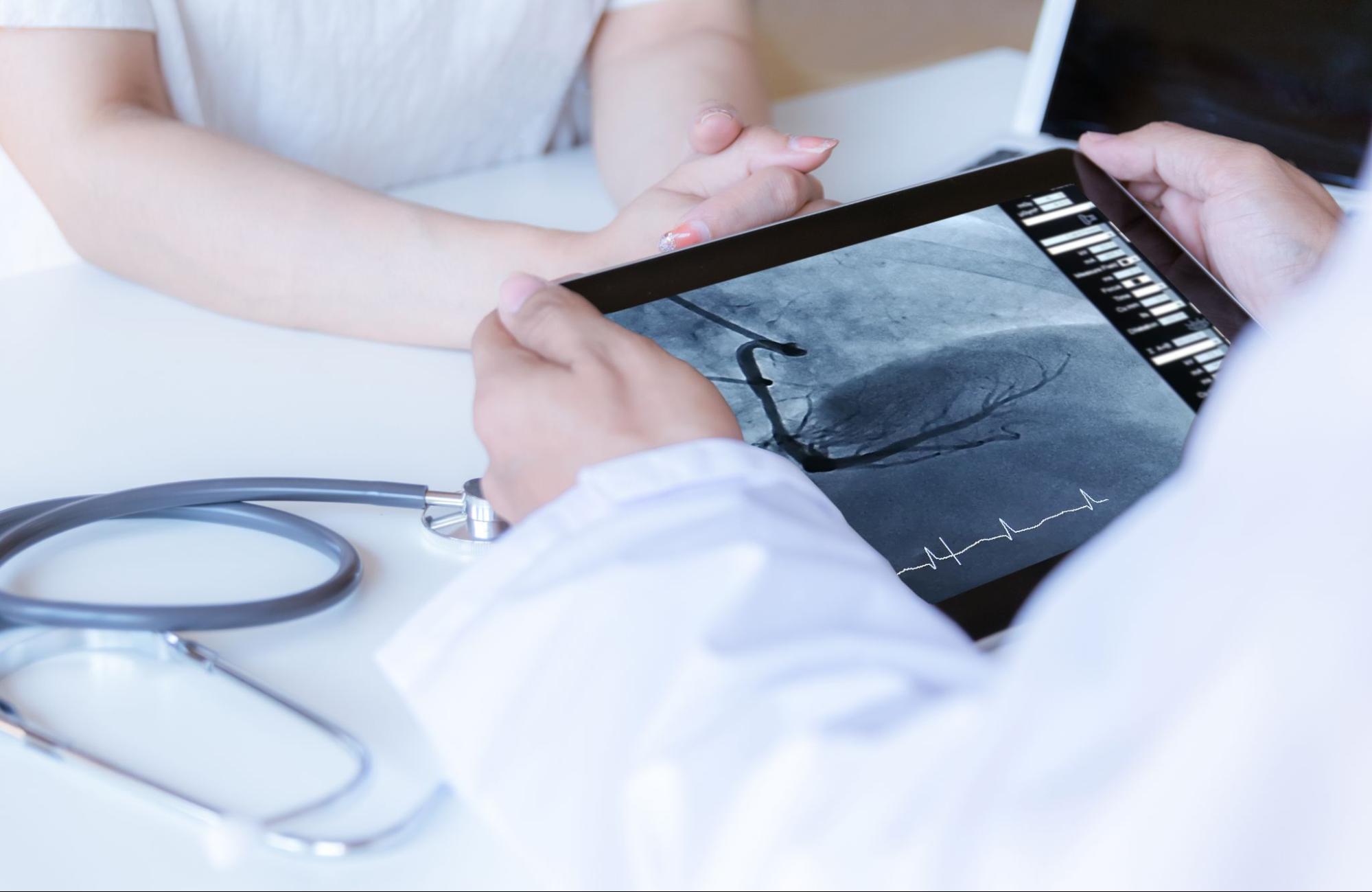 Lékař ukazuje pacientovi výsledky koronární angiografie na tabletu