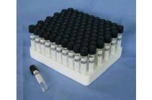 Vacutainer skúmavka Čierna - 5 ml, 366674 (100 ks/bal.)