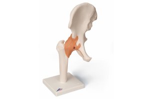 Model bedrového kĺbu