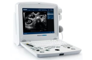 Ultrazvukový skener EDAN DUS60